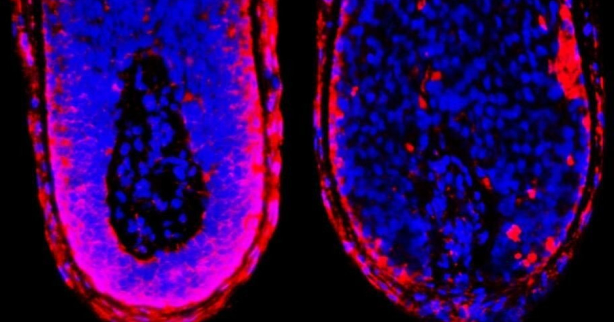 研究者は古代の生物学的メカニズムをブロックすることで脱毛を防ぐ