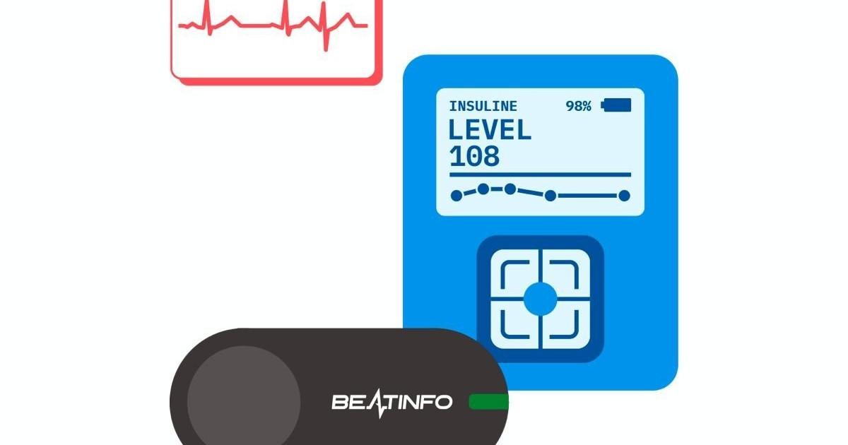 心電図による非侵襲的持続血糖モニタリング装置!