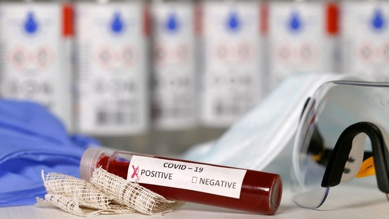 Συνδυασμός γνωστών φαρμάκων ίσως επιταχύνει δραματικά την ανάρρωση από COVID-19 1