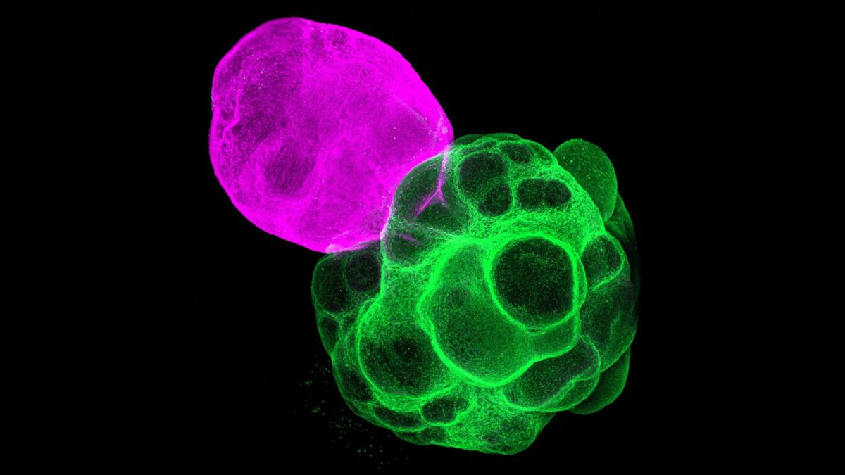 &Iota;ά&pi;&omega;&nu;&epsilon;&sigmaf;