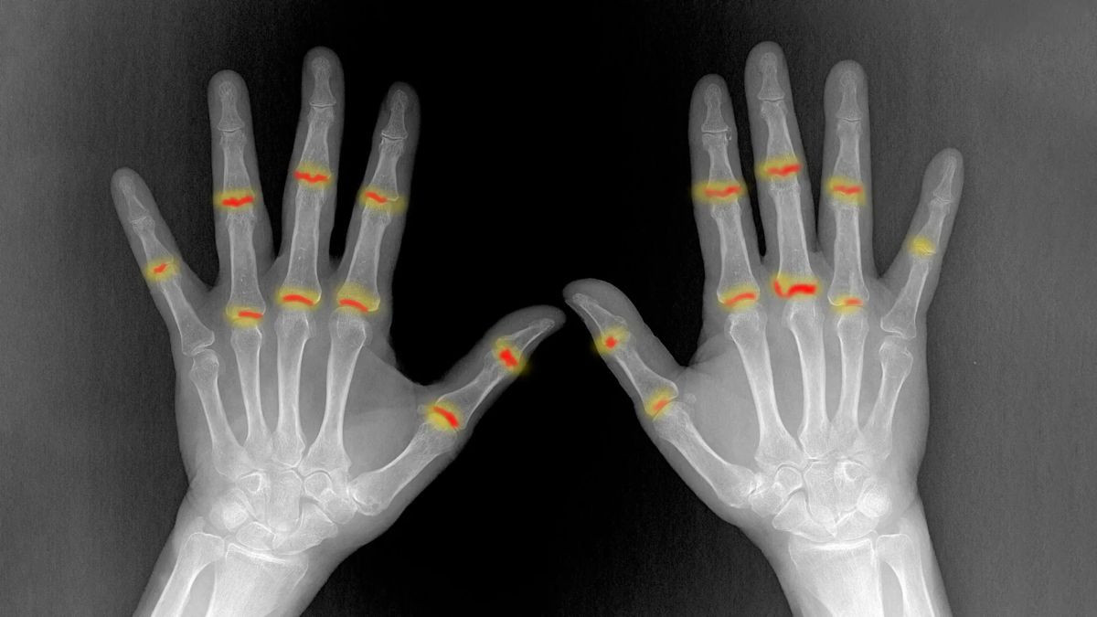 &Psi;&omega;&rho;ί&alpha;&sigma;&eta;